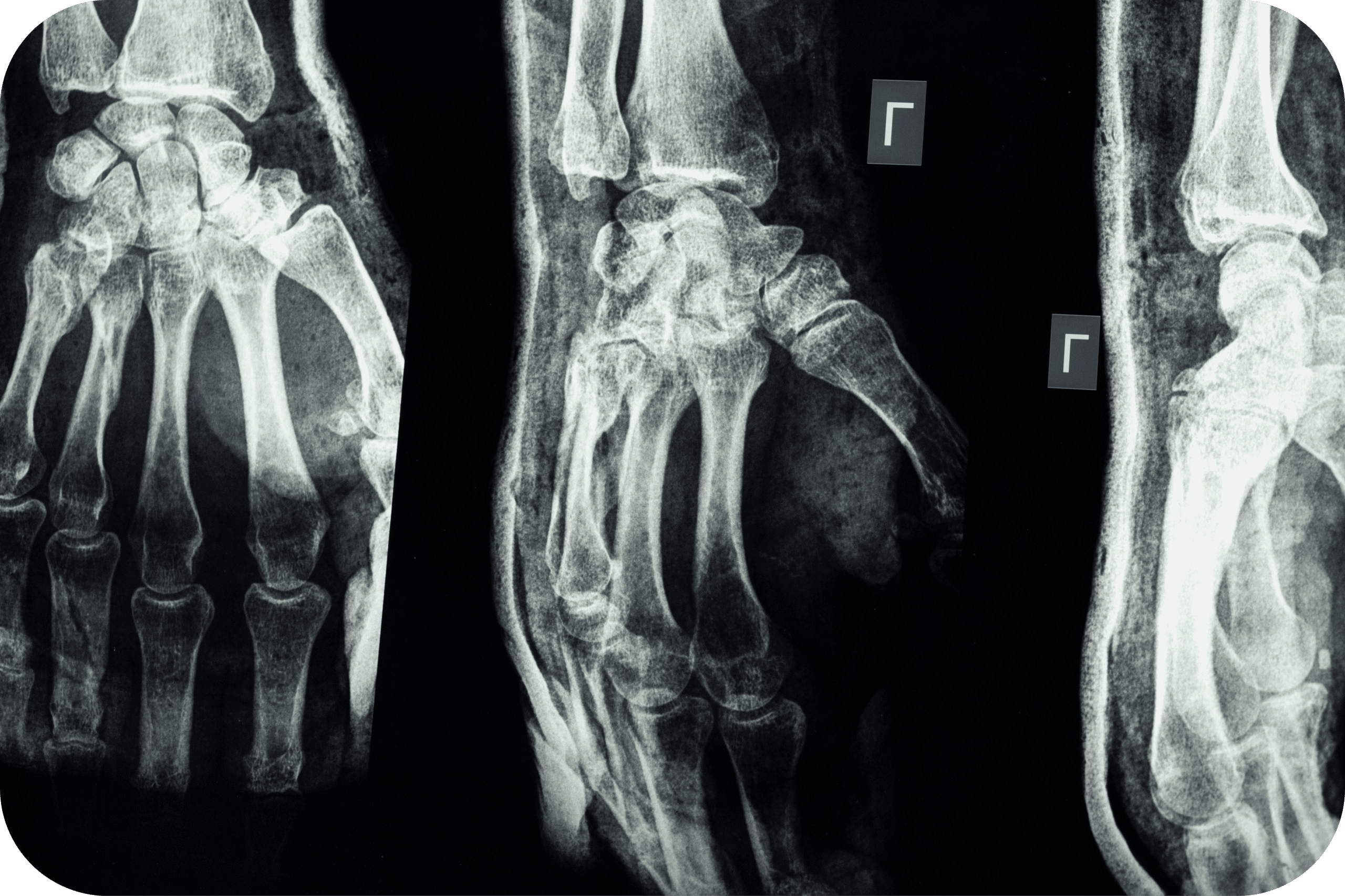 Medical image